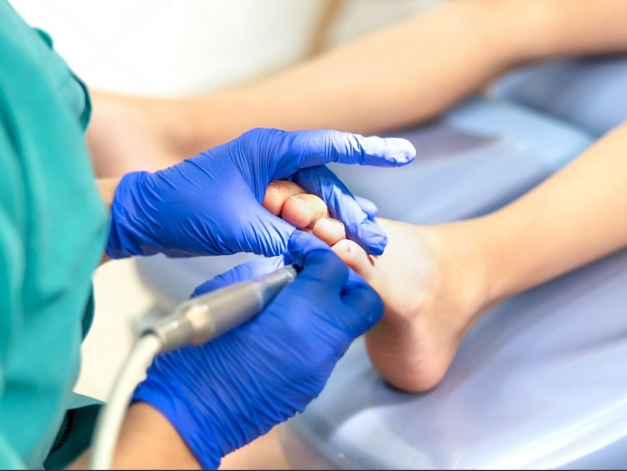Fungal Nail Treatment from £60
